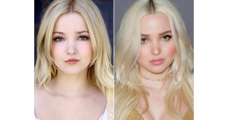 All About Dove Cameron Plastic Surgery Operations